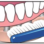 IL_Implant_Orthodontic+Brush_1900
