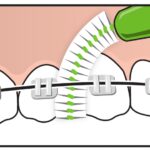 interdent_graph_1