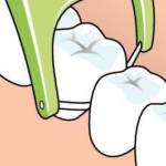 IL_Miniflosser_Transparent PNG_7263